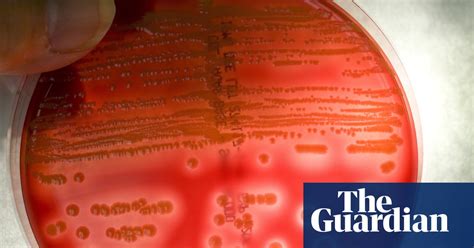 U.S. Farmers Destroy Lettuce Crops Amid Consumer Fears Over Cyclosporosis Outbreak